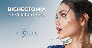 Bichectomia en Villahermosa